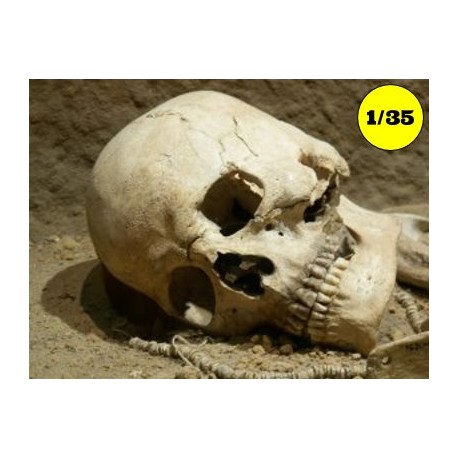 menselijke schedel